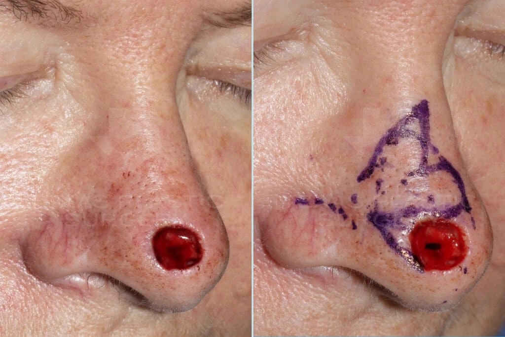 Real Patient results in San Antonio, TX Performed by Texas Plastic Surgery