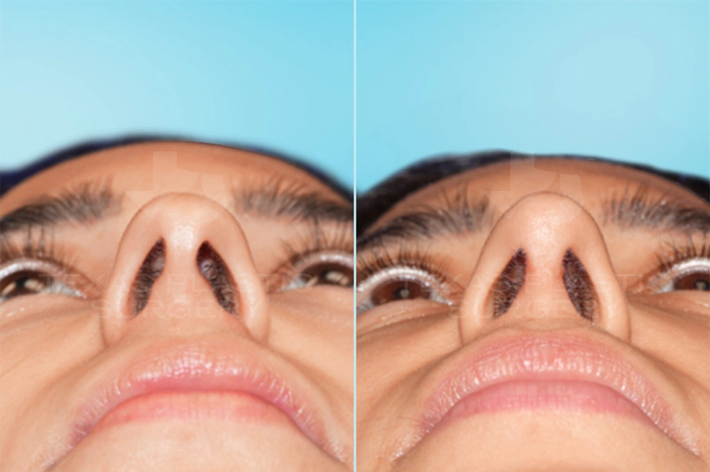 Real Patient results in San Antonio, TX Performed by Texas Plastic Surgery