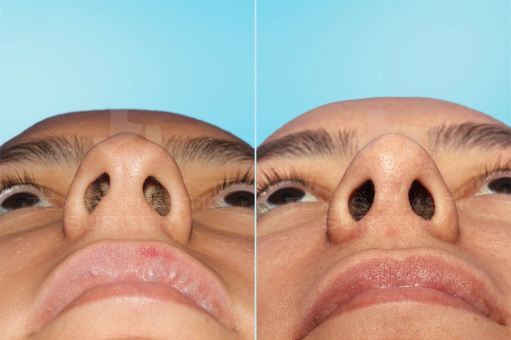 Real Patient results in San Antonio, TX Performed by Texas Plastic Surgery