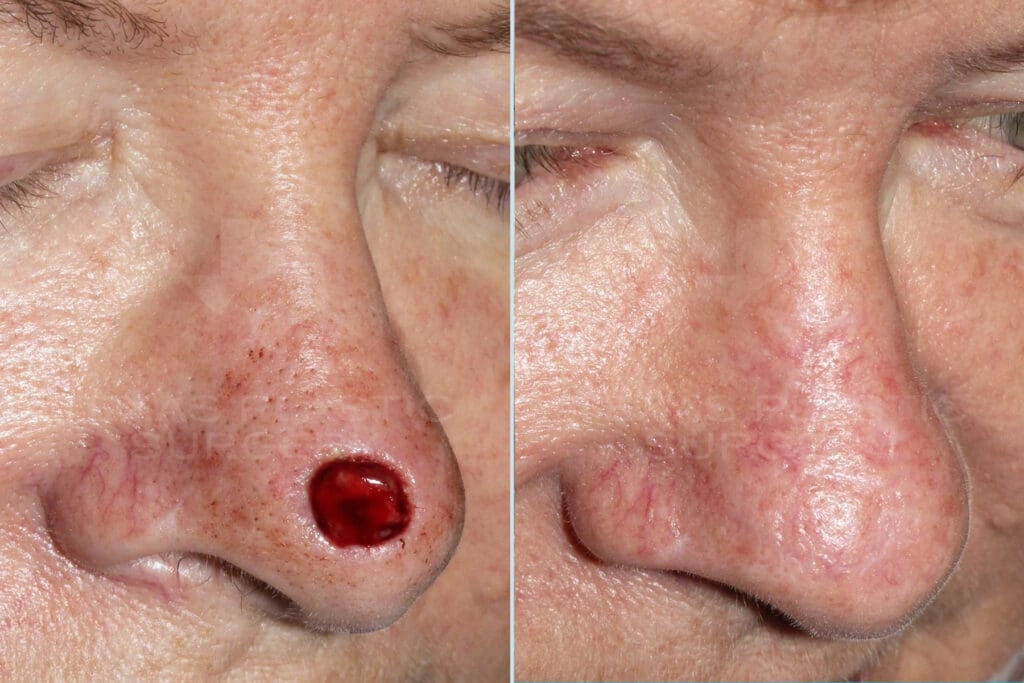 Real Patient results in San Antonio, TX Performed by Texas Plastic Surgery