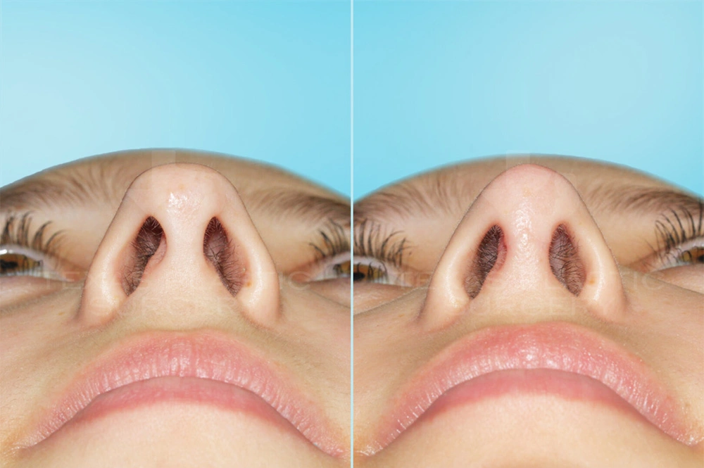 Real Patient results in San Antonio, TX Performed by Texas Plastic Surgery