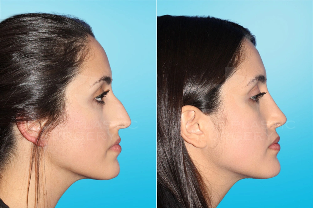 Real Patient results in San Antonio, TX Performed by Texas Plastic Surgery