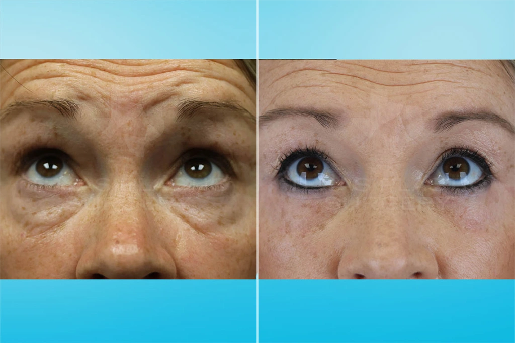 Real Patient results in San Antonio, TX Performed by Texas Plastic Surgery