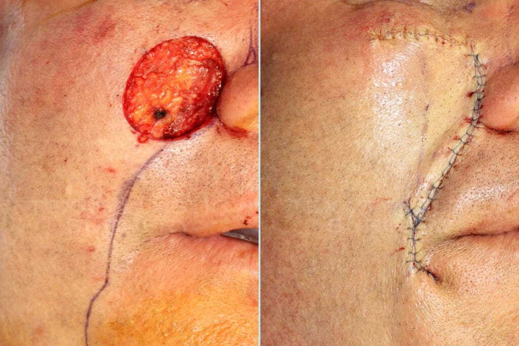 Real Patient results in San Antonio, TX Performed by Texas Plastic Surgery
