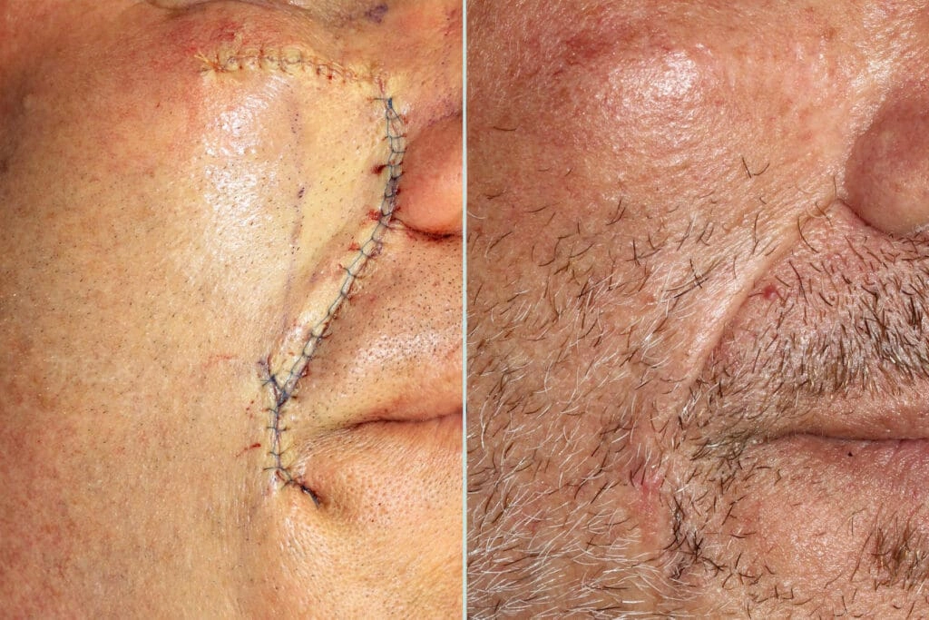Real Patient results in San Antonio, TX Performed by Texas Plastic Surgery