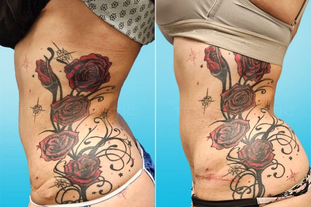 Real Patient results in San Antonio, TX Performed by Texas Plastic Surgery